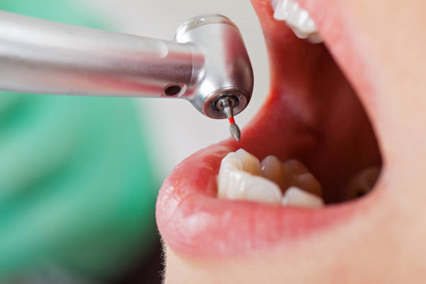 Best Tooth Infection Emergency Dentist  in Lake Catherine, IL